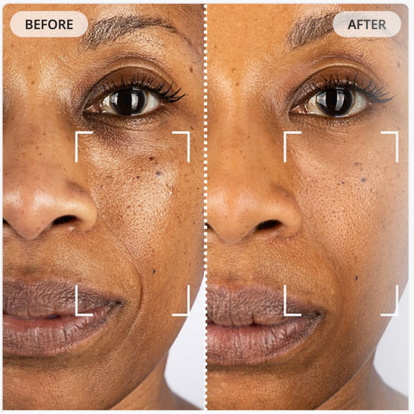 Repair & rejuvenate your skin with our Light Therapy Mask