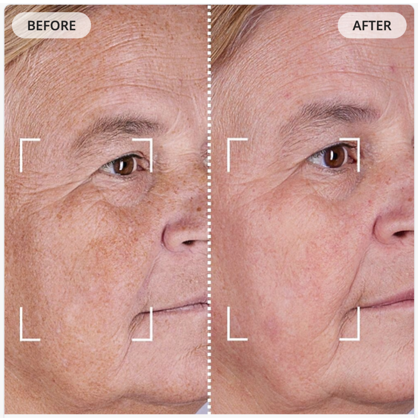 Repair & rejuvenate your skin with our Light Therapy Mask