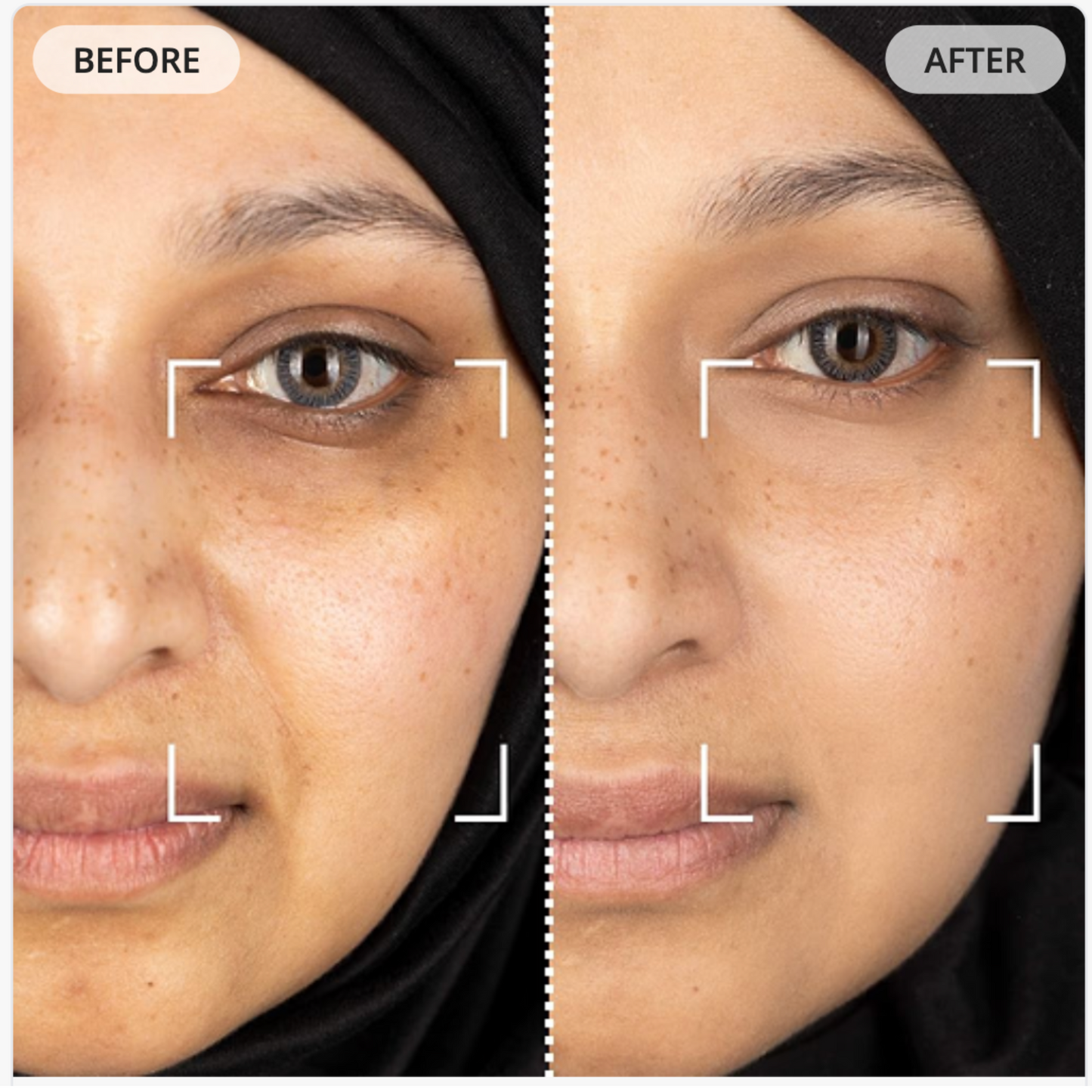 Repair & rejuvenate your skin with our Light Therapy Mask
